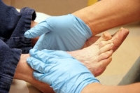 The Diabetic Foot