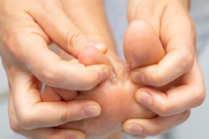 Risk Factors and Symptoms of Athlete’s Foot