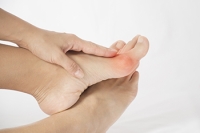 Can Bunions Be Treated?