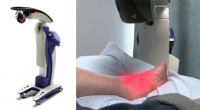 Can Shockwave Therapy Help Plantar Fasciitis?