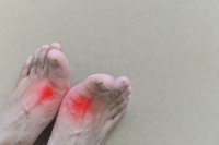 Signs That You May Have Gout