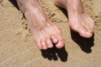 Hammertoe Affects Toe Joints