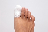 Reasons Why a Broken Toe Can Occur